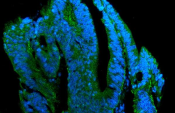 Anti-Claudin 7/CLDN-7 Antibody