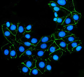 Anti-Claudin 7/CLDN-7 Antibody
