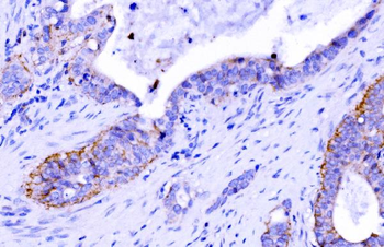 Anti-Claudin 7/CLDN-7 Antibody