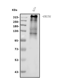 Collagen VII/COL7A1 Antibody