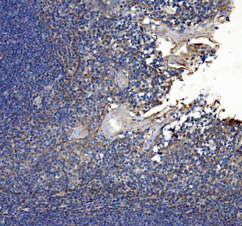 Anti-Collagen VII/COL7A1 Antibody