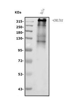 Anti-Collagen VII/COL7A1 Antibody