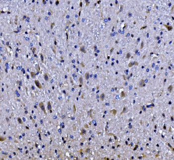 Anti-EEF2/Elongation factor 2 Antibody