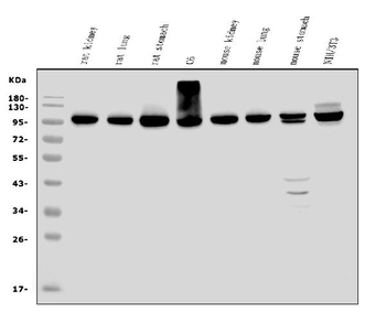 Anti-EEF2/Elongation factor 2 Antibody