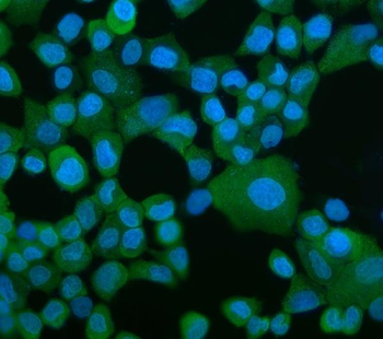 Anti-EEF2/Elongation factor 2 Antibody