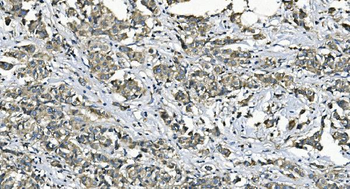 Anti-EEF2/Elongation factor 2 Antibody