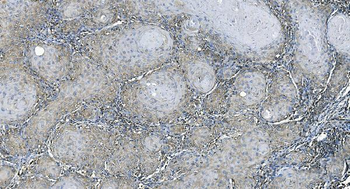 Anti-EEF2/Elongation factor 2 Antibody