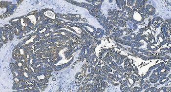 Anti-EEF2/Elongation factor 2 Antibody