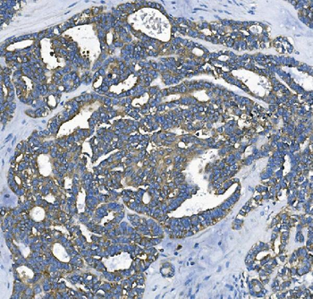Anti-EEF2/Elongation factor 2 Antibody