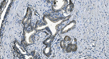 Anti-EEF2/Elongation factor 2 Antibody