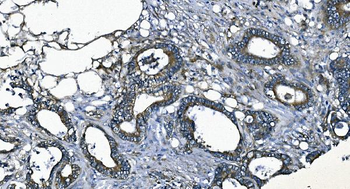 Anti-EEF2/Elongation factor 2 Antibody