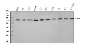 Anti-GMPS Antibody