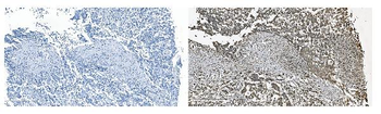 Anti-GRSF1 Antibody
