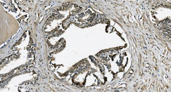 Anti-GRSF1 Antibody