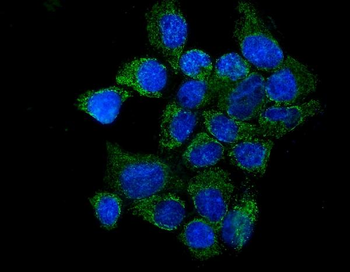 Anti-IL37 Antibody