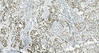 Anti-IL37 Antibody