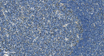 Anti-IL37 Antibody
