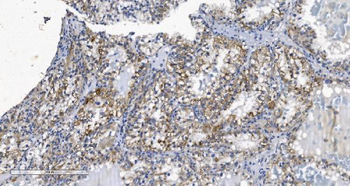 Anti-KCNQ5 Antibody