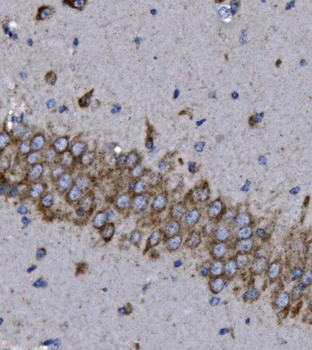 Anti-KCNQ5 Antibody