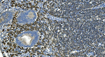Anti-CD20/MS4A1 Antibody