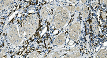 Anti-CD20/MS4A1 Antibody