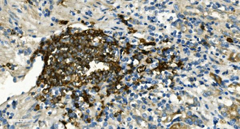 Anti-CD20/MS4A1 Antibody