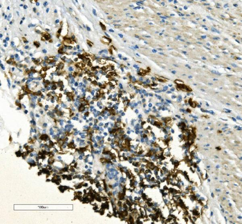 Anti-CD20/MS4A1 Antibody