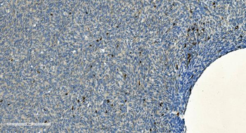Anti-CD20/MS4A1 Antibody