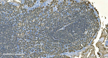 Anti-CD20/MS4A1 Antibody