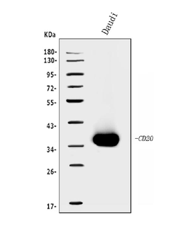 Anti-CD20/MS4A1 Antibody