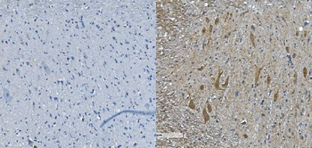 Anti-Nefh Antibody