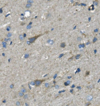 Anti-Nefh Antibody