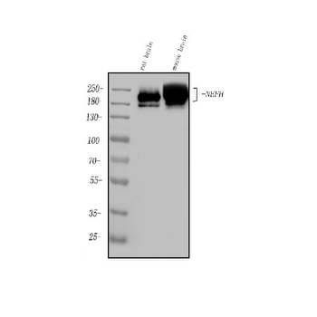 Anti-Nefh Antibody