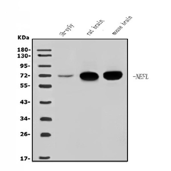 NEFL/NF-L Antibody
