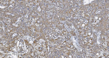 Anti-CARD4/NOD1 Antibody