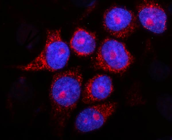Anti-Presenilin 2/AD5/PSEN2 Antibody