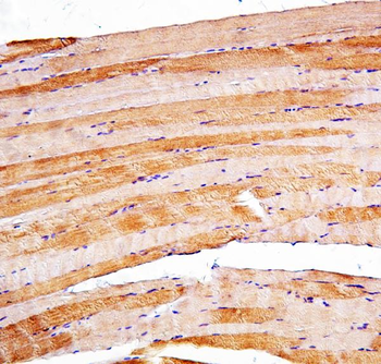 Anti-Presenilin 2/AD5/PSEN2 Antibody