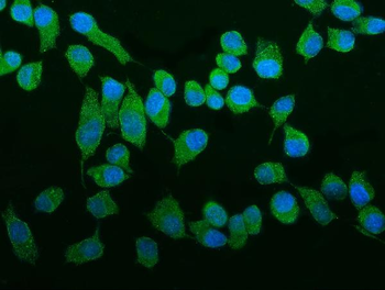 Anti-ROCK2 Antibody