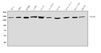 Anti-ROCK2 Antibody
