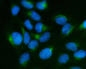 Anti-SCG10/STMN2 Antibody