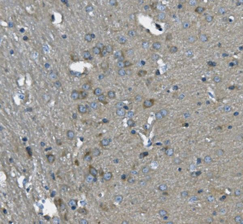 Anti-SCG10/STMN2 Antibody