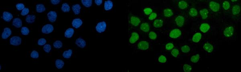 Anti-PARP/PARP1 Antibody (monoclonal, 2I2H4)