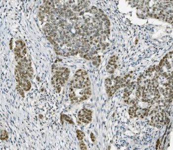 Anti-PARP/PARP1 Antibody (monoclonal, 2I2H4)