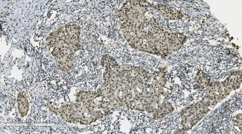 Anti-PARP/PARP1 Antibody (monoclonal, 2I2H4)