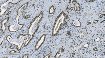Anti-PARP/PARP1 Antibody (monoclonal, 2I2H4)