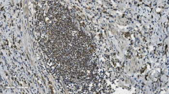 Anti-PARP/PARP1 Antibody (monoclonal, 2I2H4)