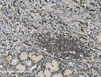Anti-PARP/PARP1 Antibody (monoclonal, 2I2H4)