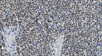 Anti-PARP/PARP1 Antibody (monoclonal, 2I2H4)