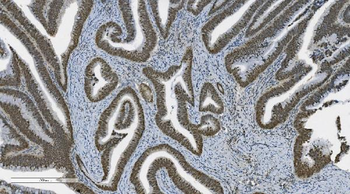Anti-PARP/PARP1 Antibody (monoclonal, 2I2H4)
