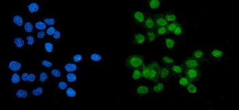 Anti-PARP/PARP1 Antibody (monoclonal, 10E11)